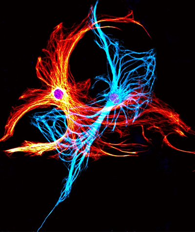 Photo of two interacting cells. One is colored fire orange, and the other is ice blue